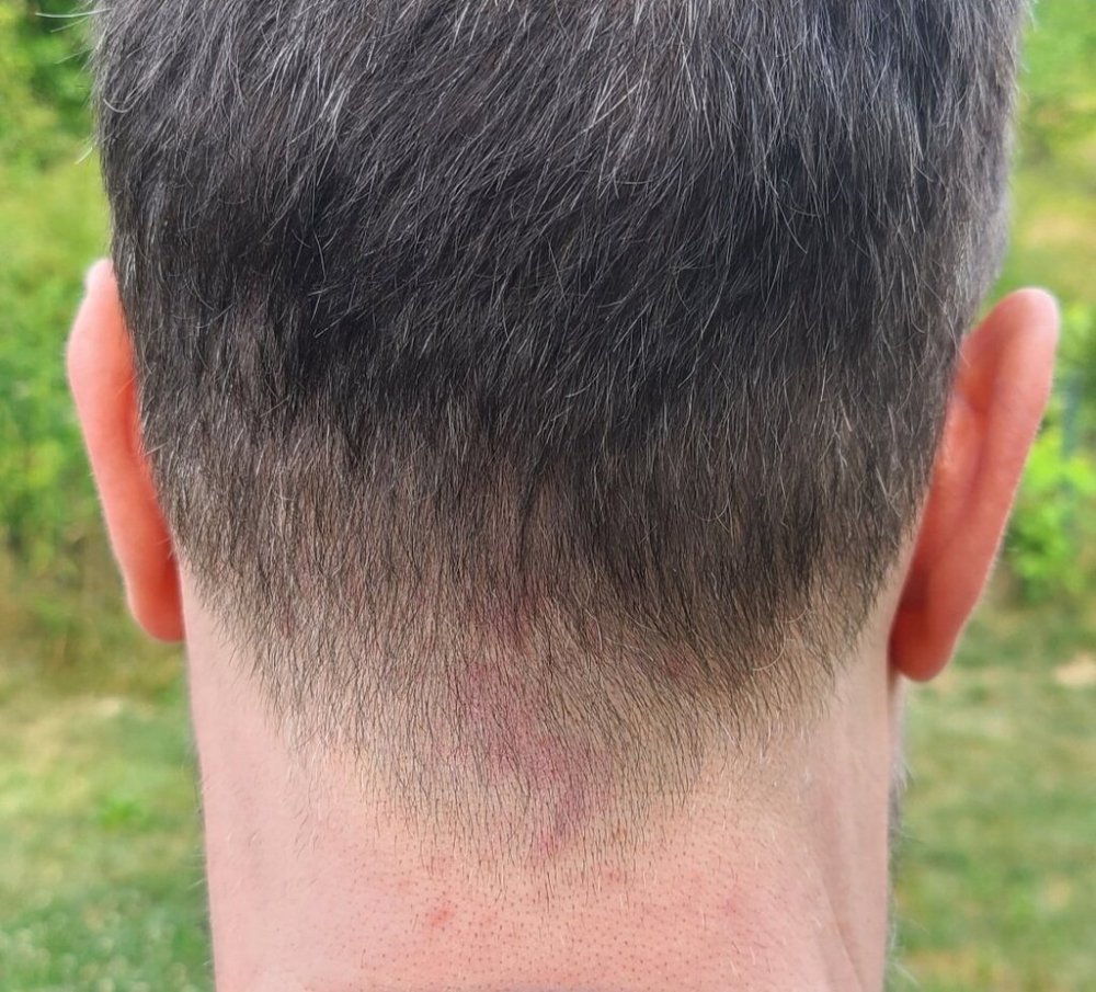 Dr Ron ShapiroDr David Josephitis of Shapiro Medical Group7 donor.jpg