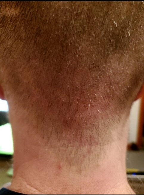 Dr Ron ShapiroDr David Josephitis of Shapiro Medical Group9 donor.jpg