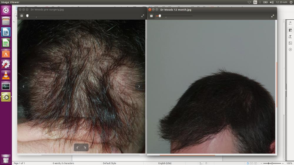 Dr Woods before and after.png