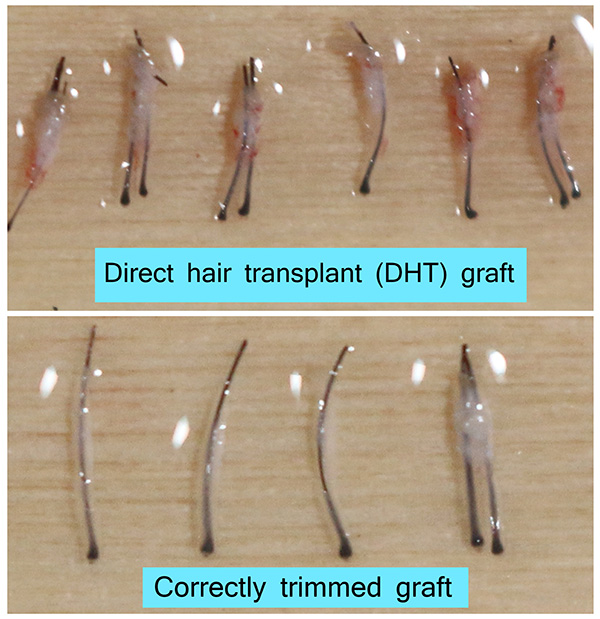 DrAsclinic  (FUE) copy.JPG
