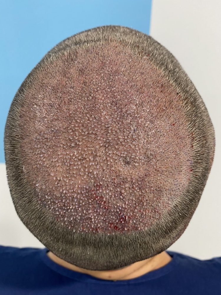 During A.jpeg