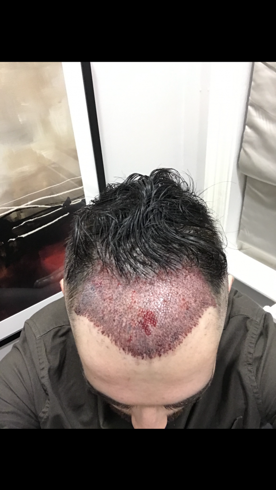 Farjo Hair Institute FUE.png