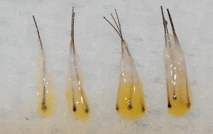 follicular unit.png