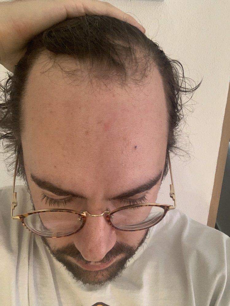 frente.jpeg