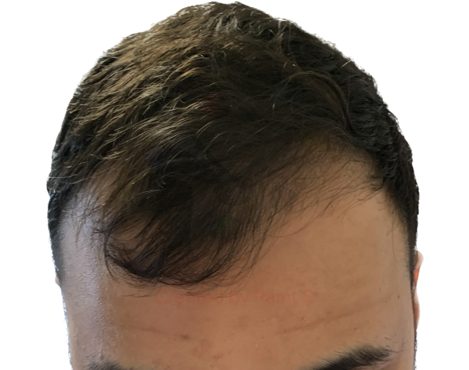 Front 1.jpg