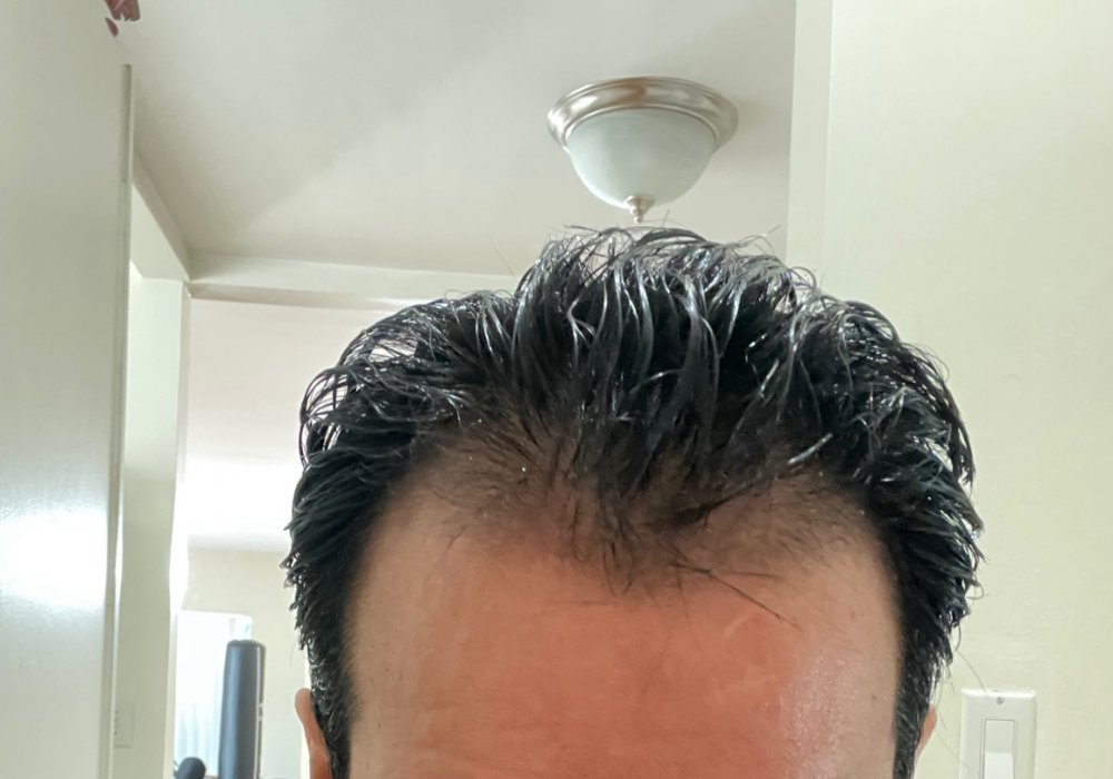 front-hair1.jpg