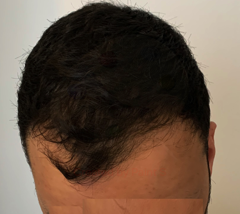 Front.jpg