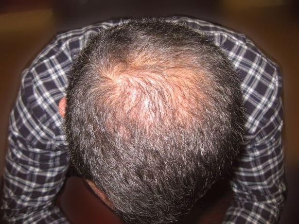 giggsy before.jpg