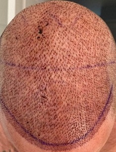 Hair Dr Leeds 1.jpeg