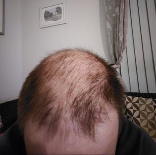 Hair Dr Leeds.jpg