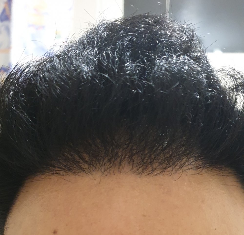Hair Growth Centre10.jpg