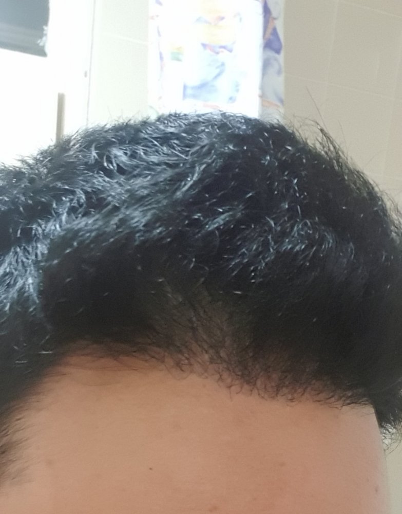 Hair Growth Centre11.jpg
