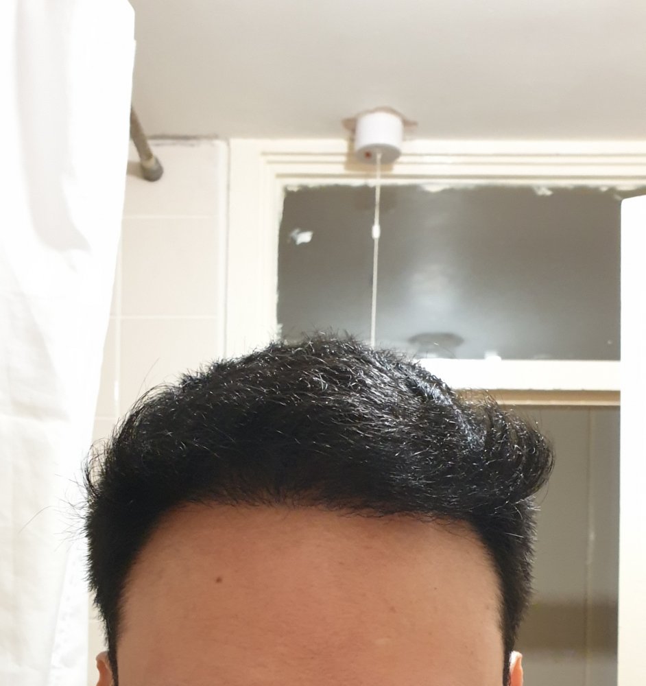 Hair Growth Centre12.jpg