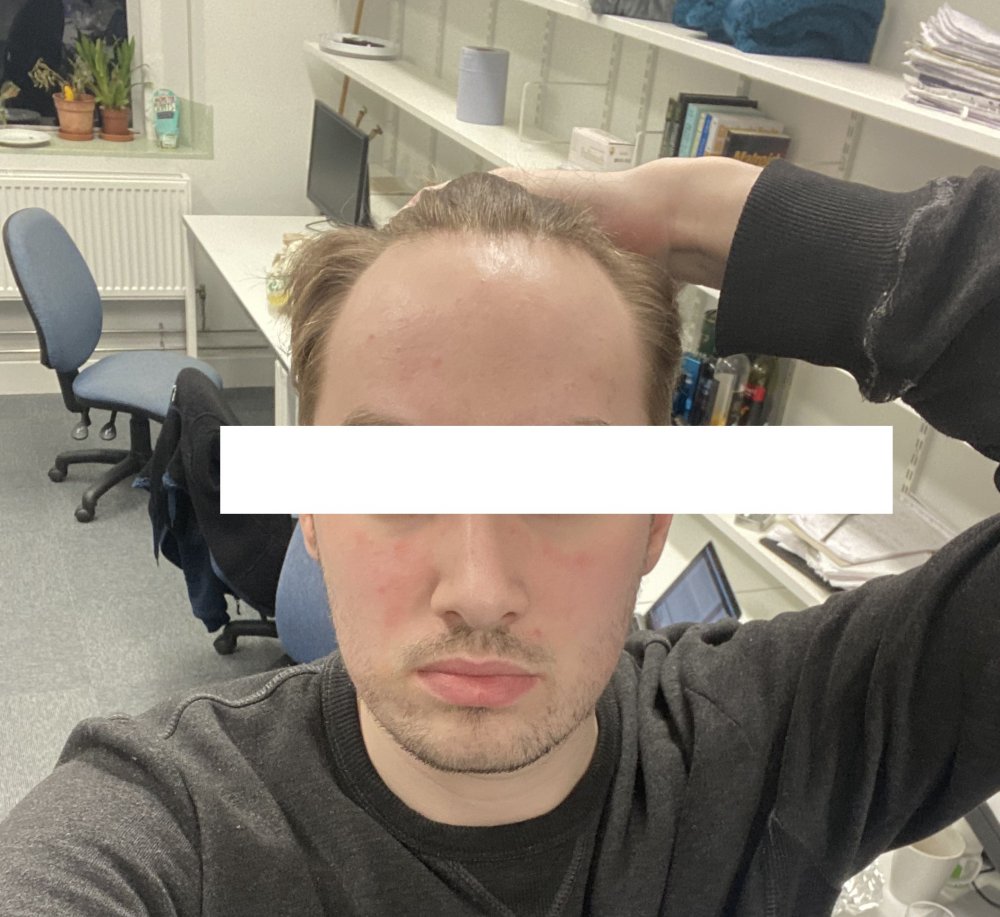 Hair.jpg