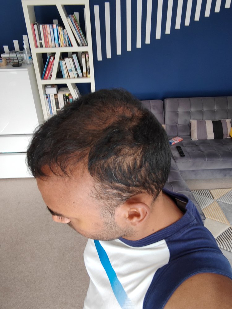 Hair Month 13 (2).jpg