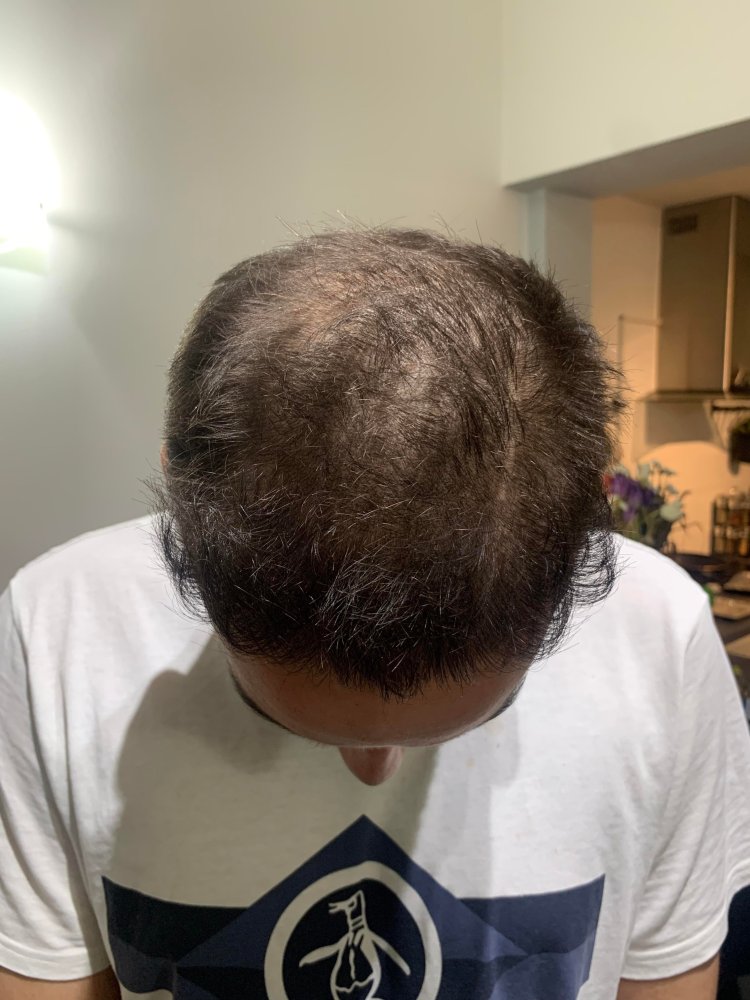 hair1.jpg