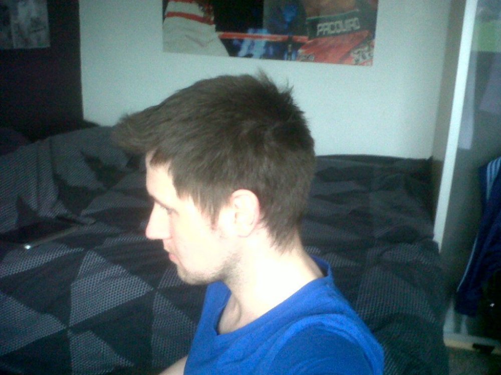 hairline by Dr. Bisanga2.jpg