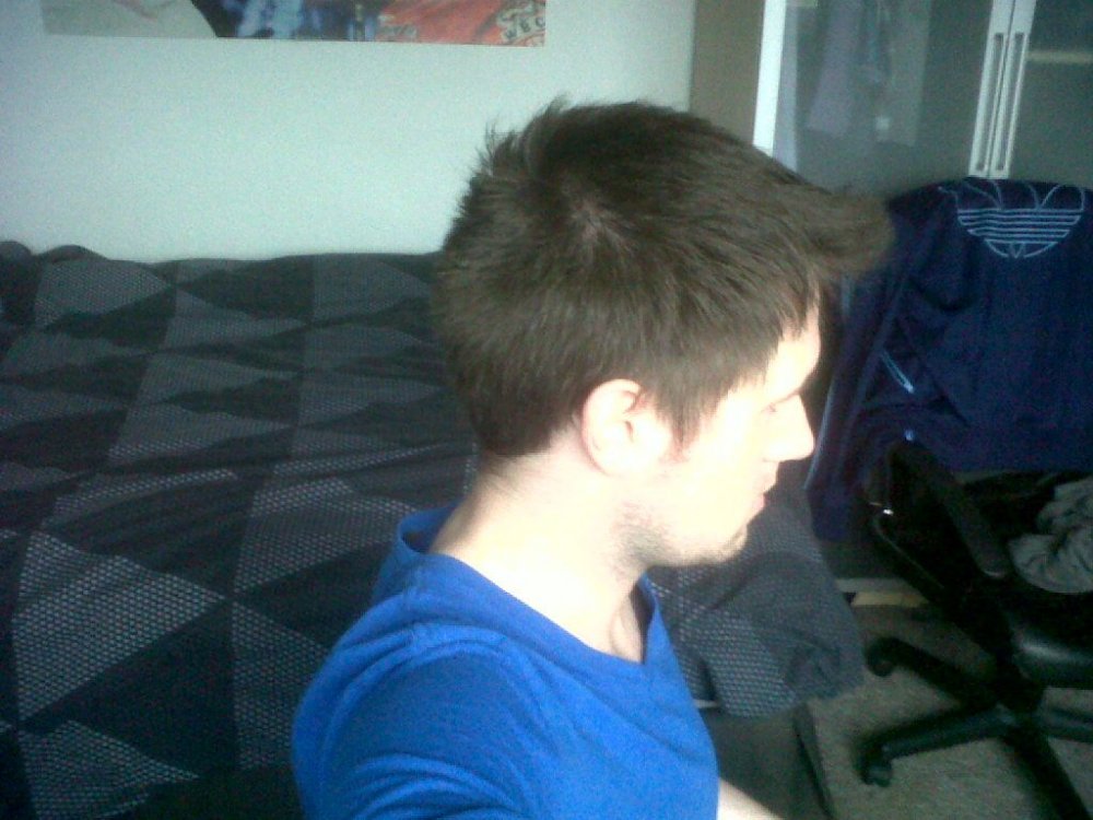 hairline by Dr. Bisanga4.jpg