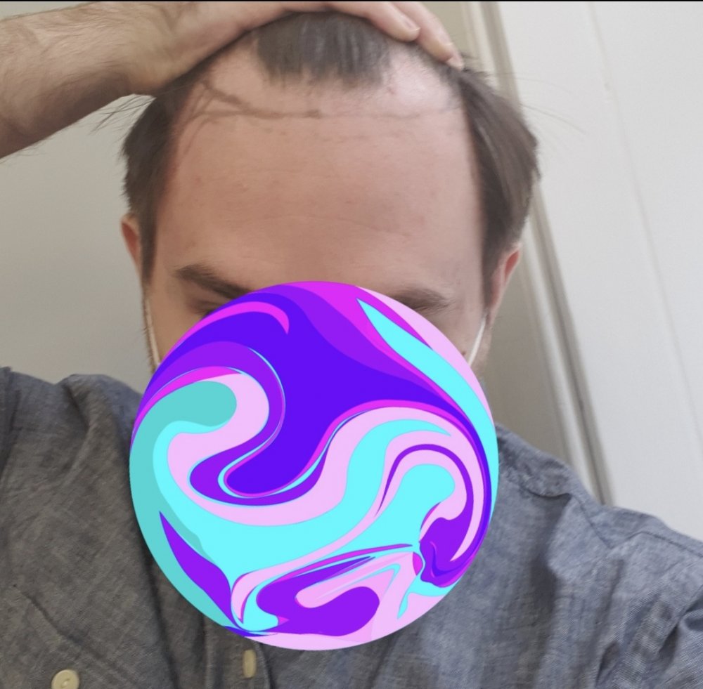 Hairline .jpg