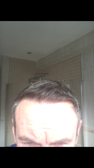 harsh light hairline.png