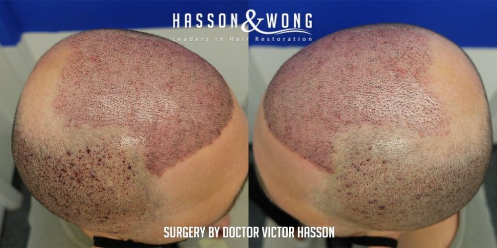 Hasson & Wong 13.jpg