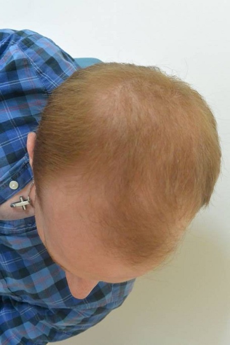 Hattingen Hair 1.jpg