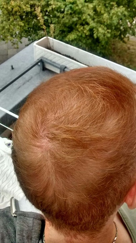 Hattingen Hair 11.jpg