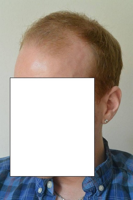 Hattingen Hair 2.jpg