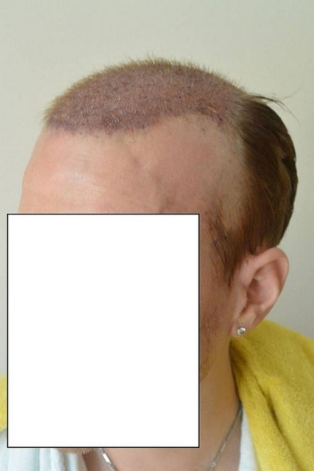 Hattingen Hair 3.jpg