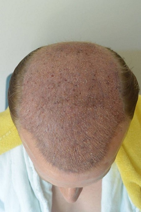 Hattingen Hair 4.jpg