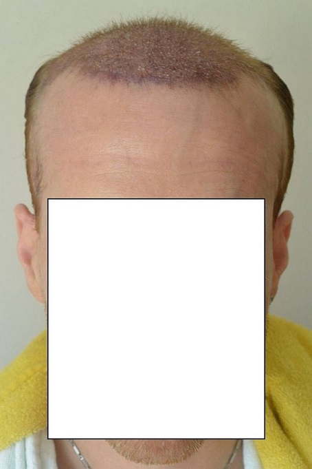 Hattingen Hair 5.jpg