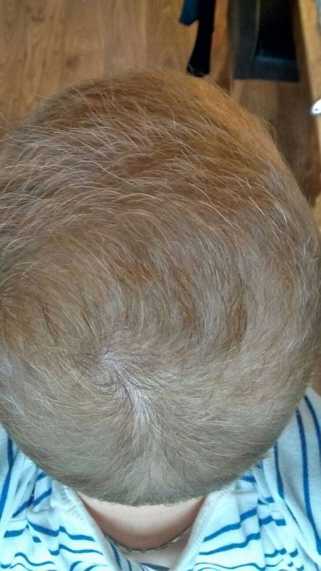 Hattingen Hair 6.jpg