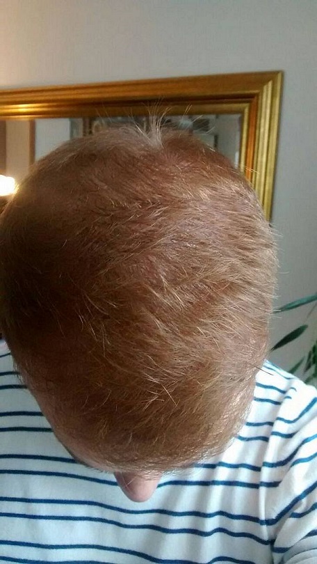 Hattingen Hair 7.jpg