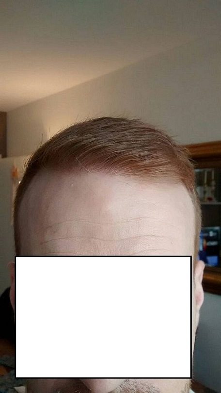 Hattingen Hair 8.jpg