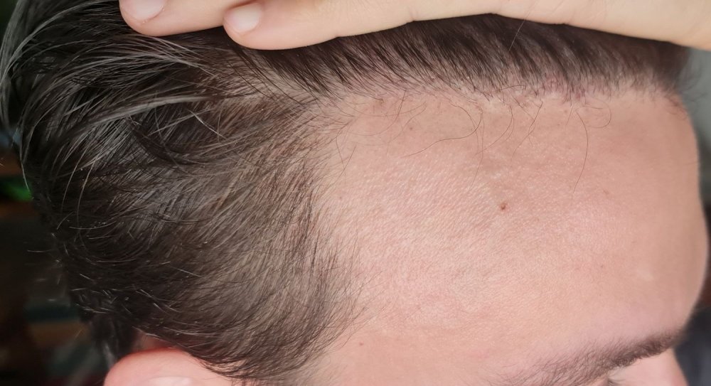 Hattingen Hair10.jpg