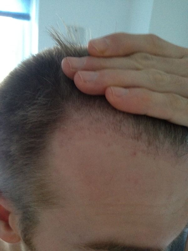 HDC Hair Clinic 2.jpg