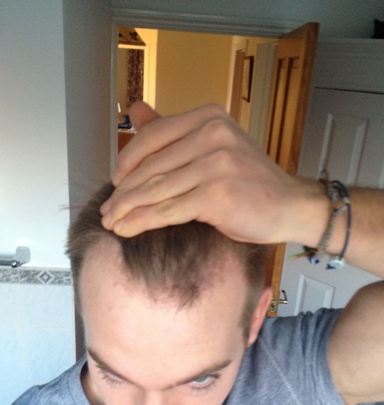 HDC Hair Clinic 3.jpg