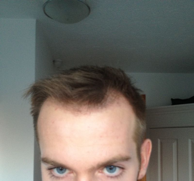 HDC Hair Clinic 4.jpg