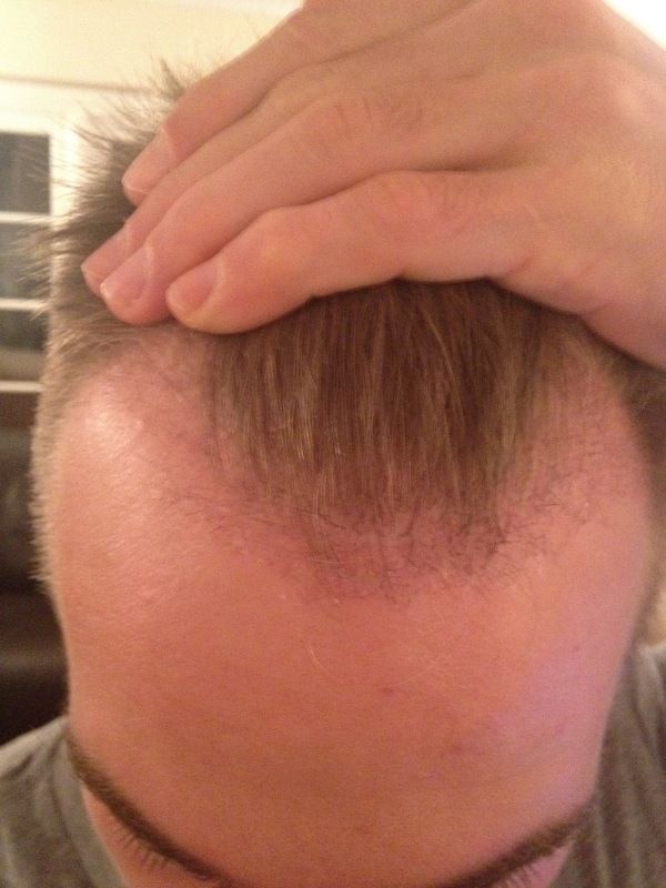 HDC Hair Clinic Cyprus.jpg