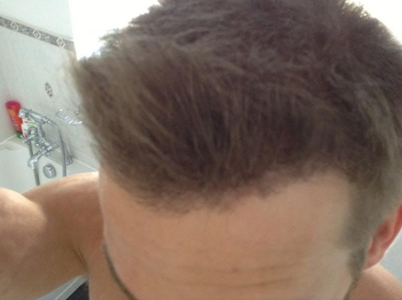 HDC Hairline1.jpg