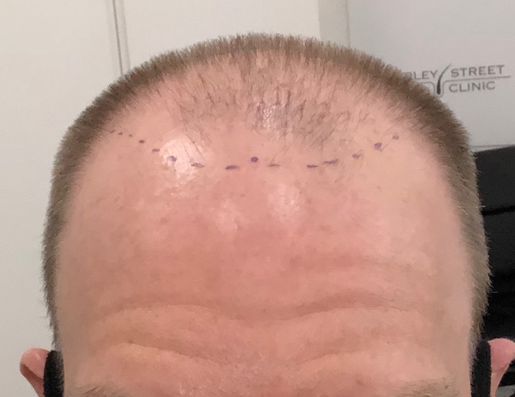 hshcproposedhairline_02.10.20.jpg