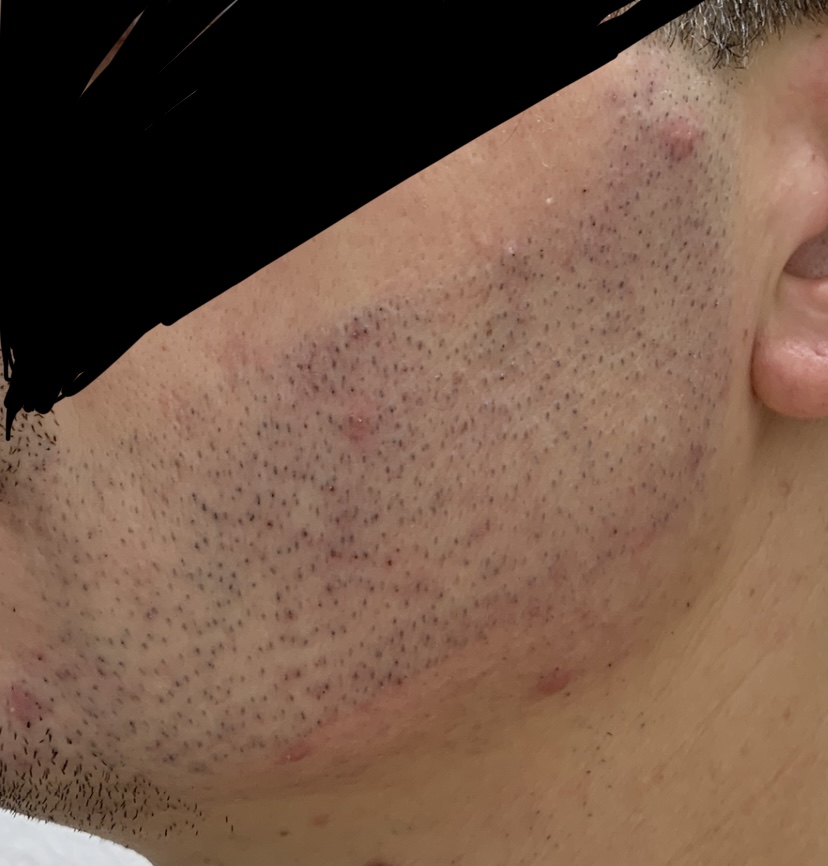 IMG-5493.jpg IMG-5493.jpg