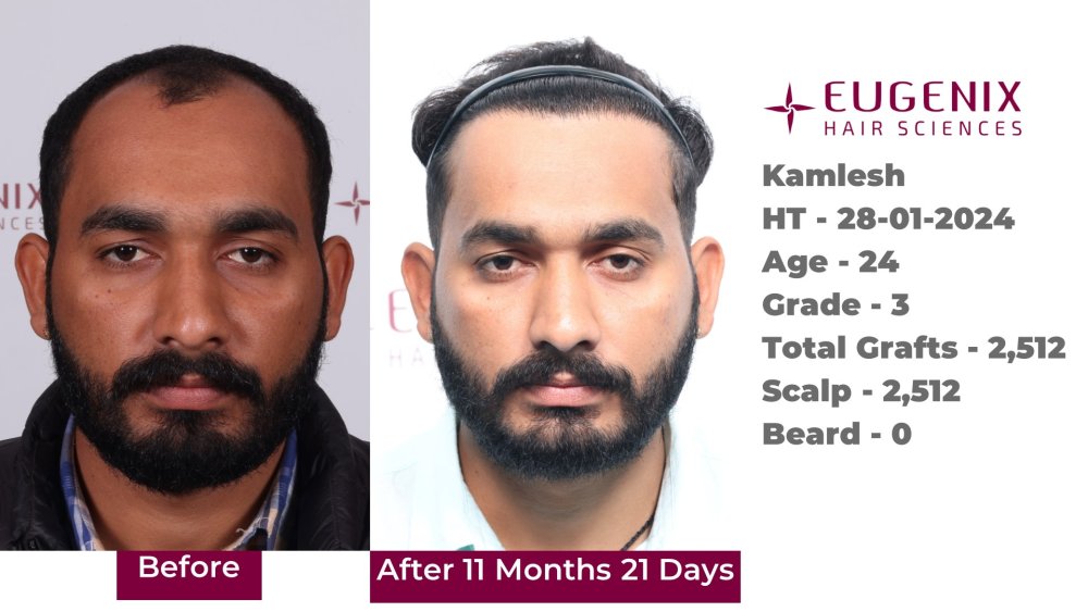 Kamlesh  PPT Format.jpg