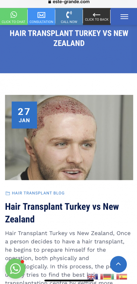 Kyle Christie Geordie Shore Hair Transplant.png