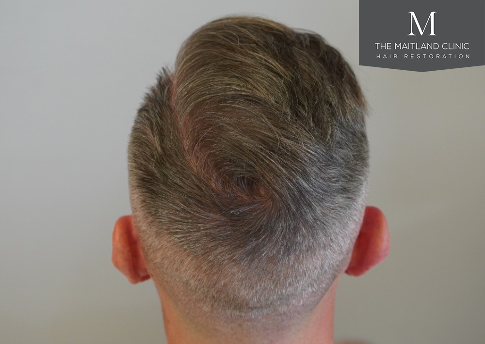 Maitland Clinic BackTilt2.jpg