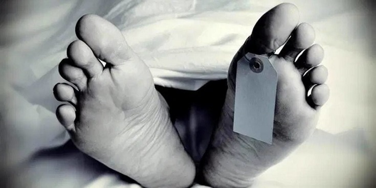Man dies after hair transplant..jpg