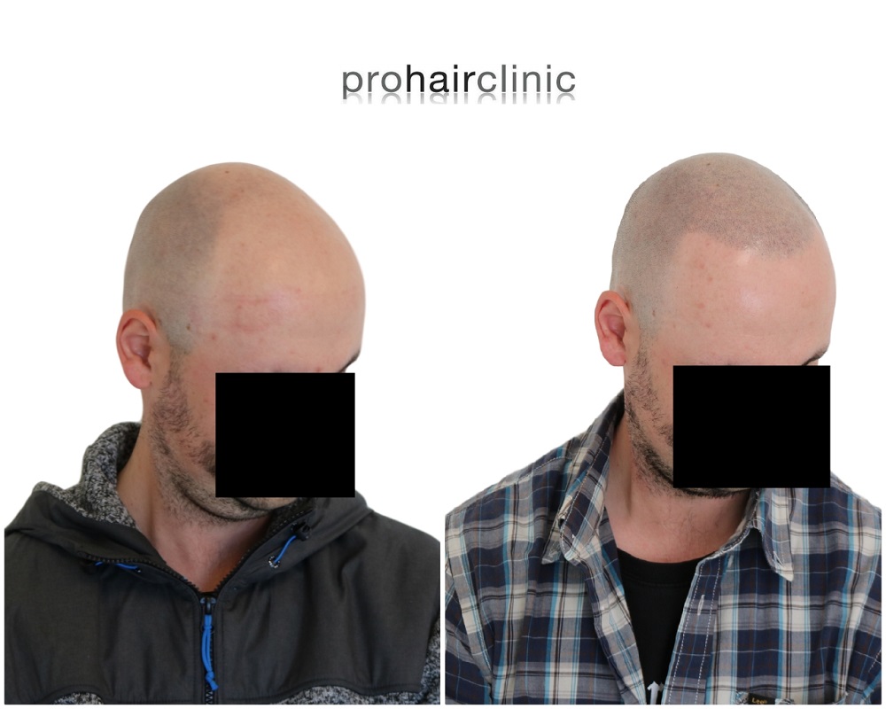 marcel rechts.jpg