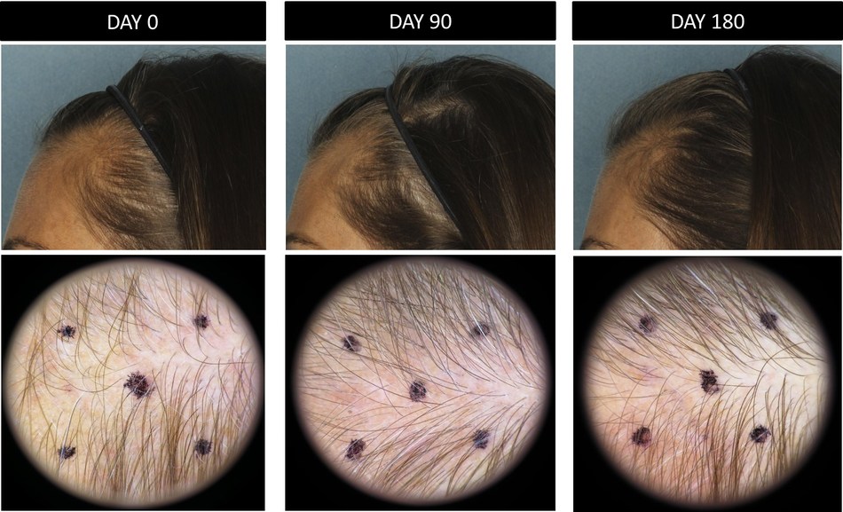 Nutrafol hair growth.jpg