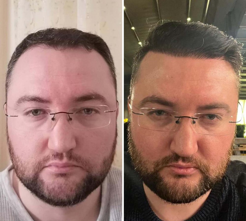 patient transformation image.jpg