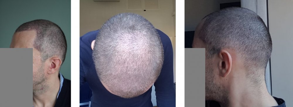 pic 10 days 3.jpg